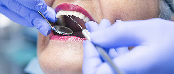 Best Emergency TMJ Treatment in Belleair, FL